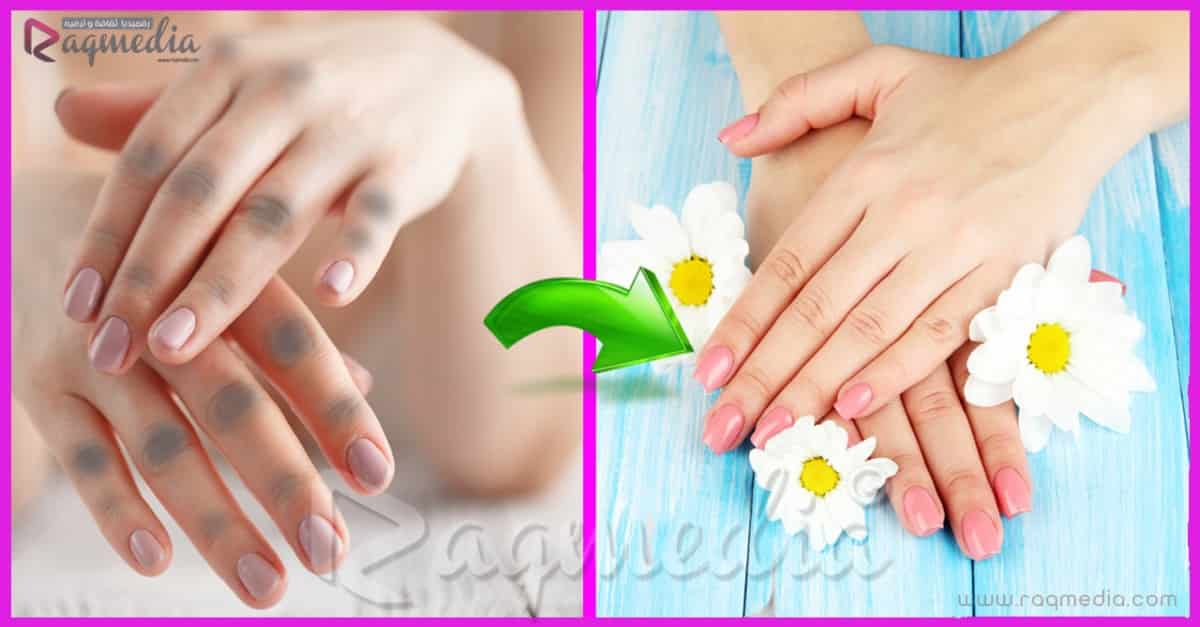 وصفة-للتخلص-من-سواد-وخشونة-مفاصل-اليدين
