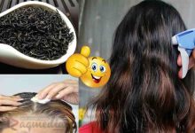 hair-loss-treatment-علاج الصلع, تقوية الشعر, طرق ناجحة لعلاج تساقط الشعر, أفضل وصفة لعلاج تساقط الشعر, مشاكل, الشعر, تنعيم, جاف, الشعر الجاف, ثقيل, ناعم, طريقة, وصفة, مجربة, الشعر ثقيل, مفرود, طويل, وصفات, شعر الجاف, علاج مشاكل الشعر, الشعر المتقصف, العناية بالشعر, لتكثيف الشعر, تساقط, علاج, كثيف, شعر كثيف و قوي, طبيعية, النصائح, أسرار, منع التساقط, موثوقة, مضمونة, جديدة, صدق, تصدق, انبات, الفراغات, HAIR REPAIR